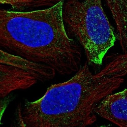 DGK-gamma Antibody, Novus Biologicals 25 &mu;L; Unlabeled:Antibodies, Polyclonal